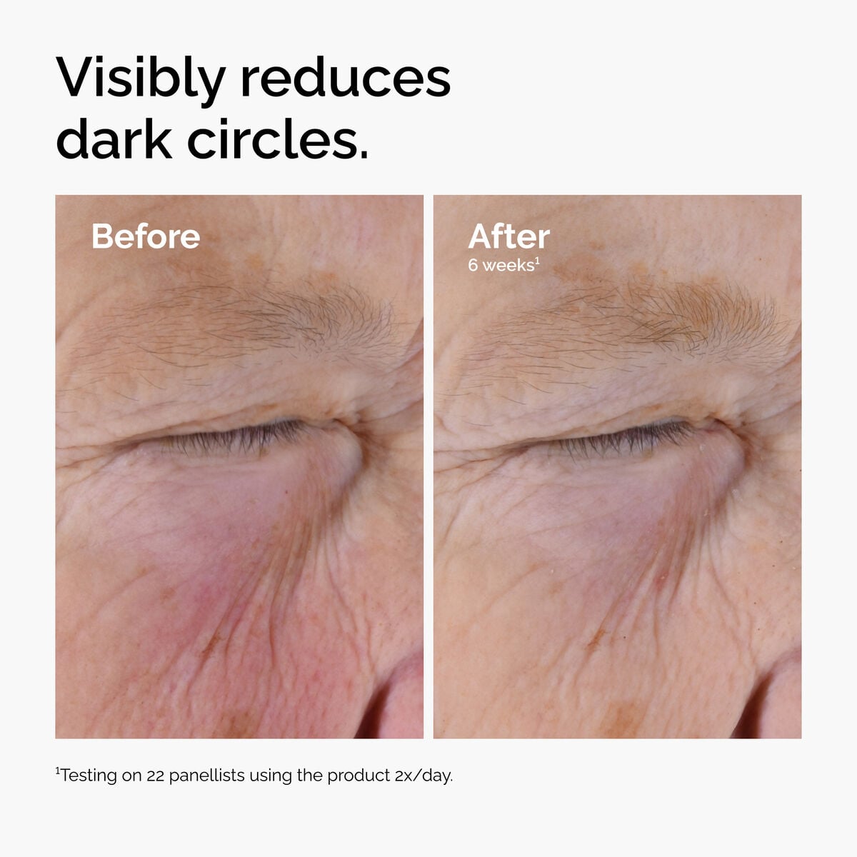 caffeine-solution-5-egcg-eye-serum-w6 ord-caffeine-solution-egcg-dark-circles-before-after.jpg