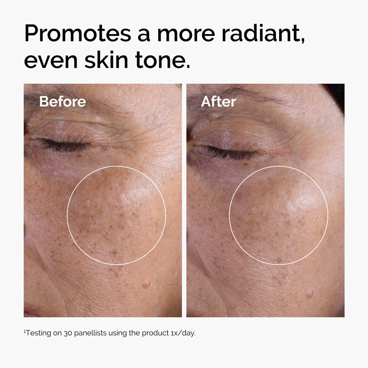 glycolic-acid-7-exfoliating-toner-z5 ord-glycolic-before-after-radiance.jpg