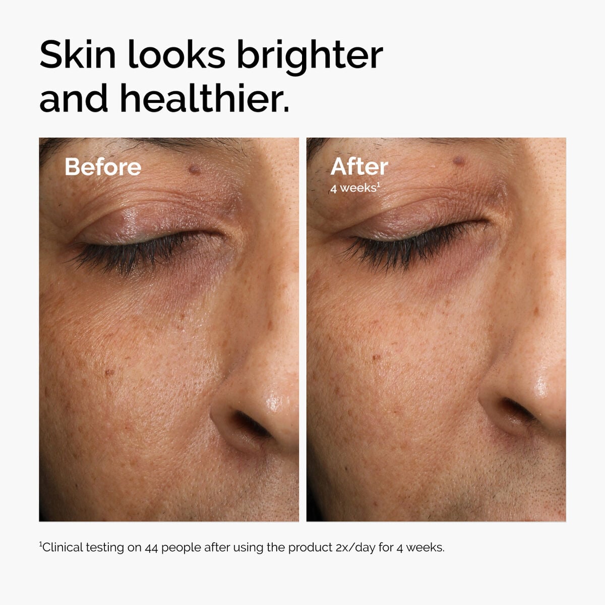 multi-antioxidant-radiance-serum-p4 ord-mars-before-after-healthy.jpg