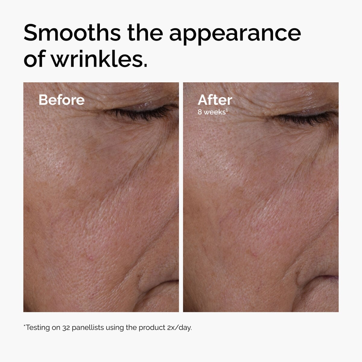 multi-peptide-ha-serum-r5 ord-multi-peptide-ha-serum-wrinkles-before-after.jpg