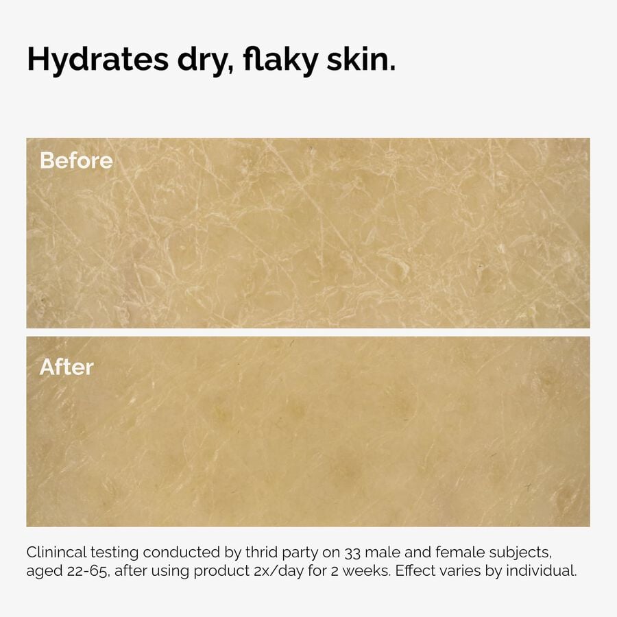 the-body-care-collection-l8 ord-natural-moisturizing-factors-inulin-body-before-after-graphic-02.jpg