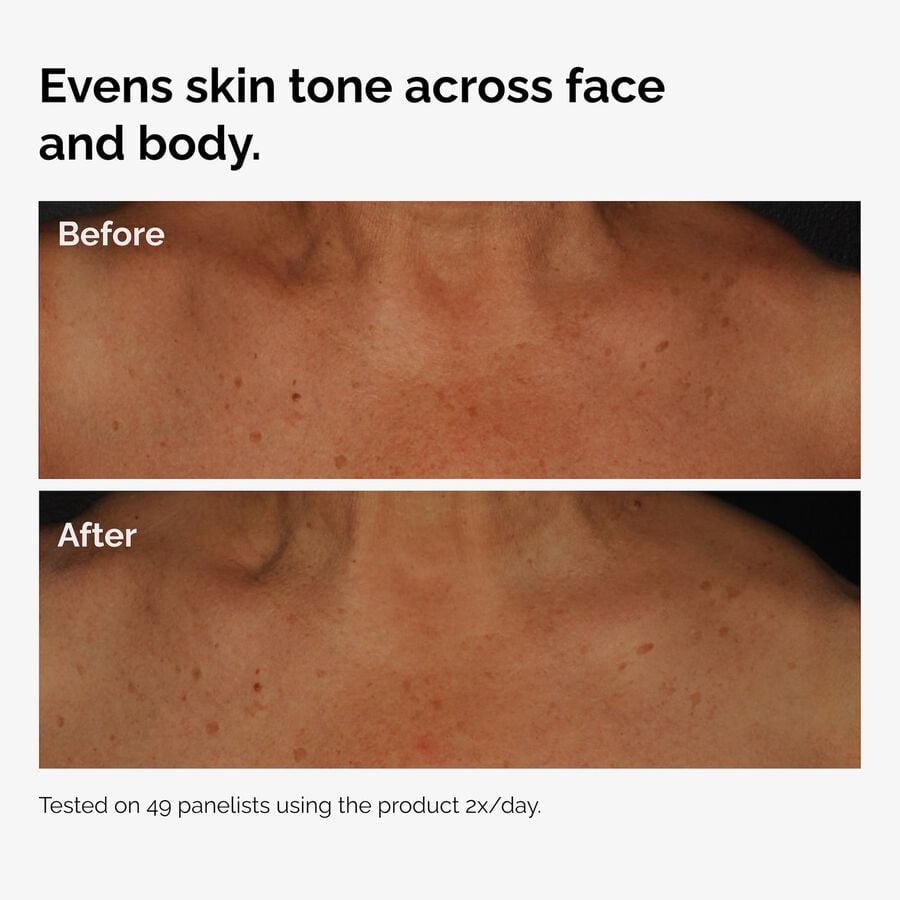 the-body-care-collection-l8 ord-niacinamide-face-body-serum-before-after-even-tone-graphic.jpg