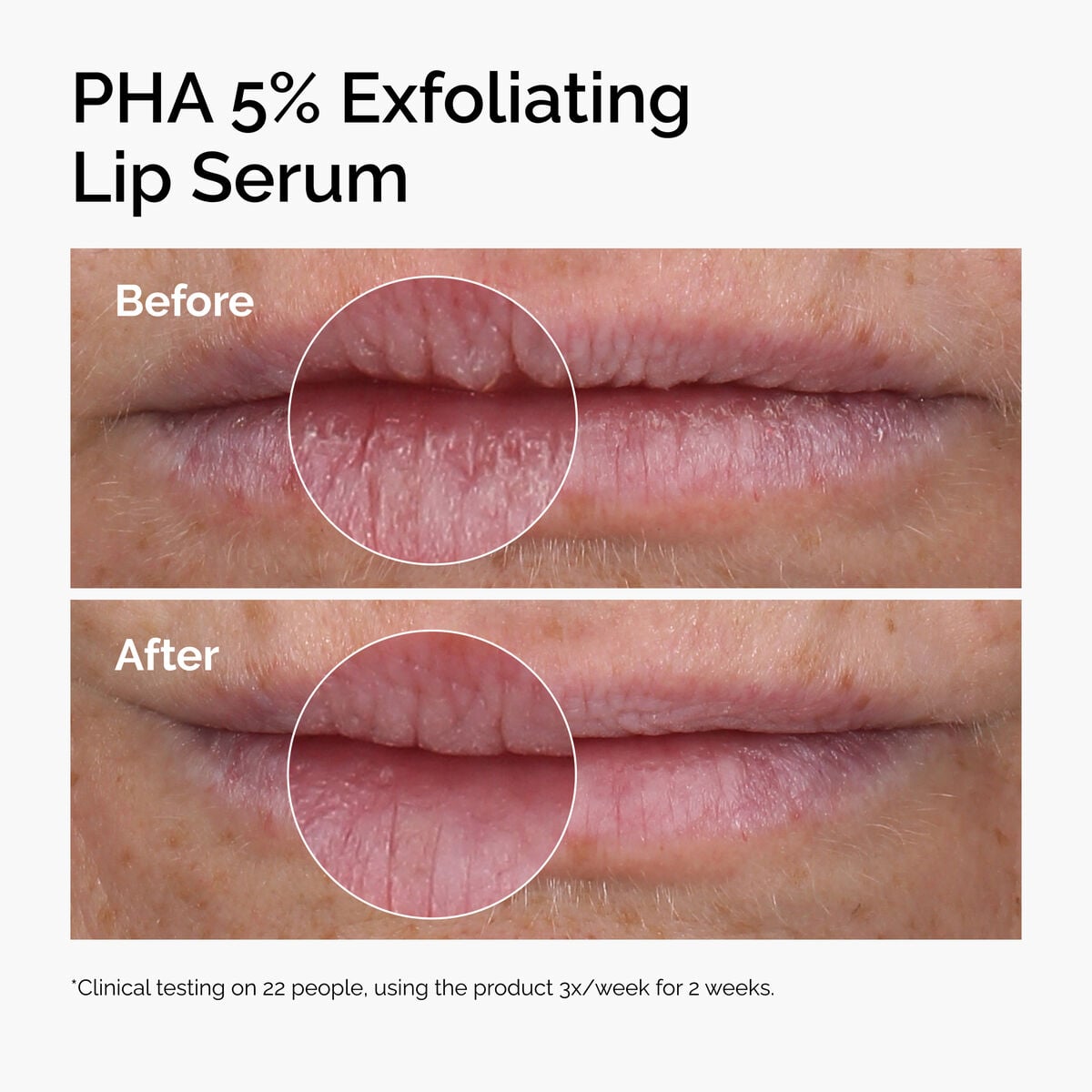 pha-5-exfoliating-lip-serum-d0 ord-pha-5pct-lip-exfoliating-serum-before-after.jpg