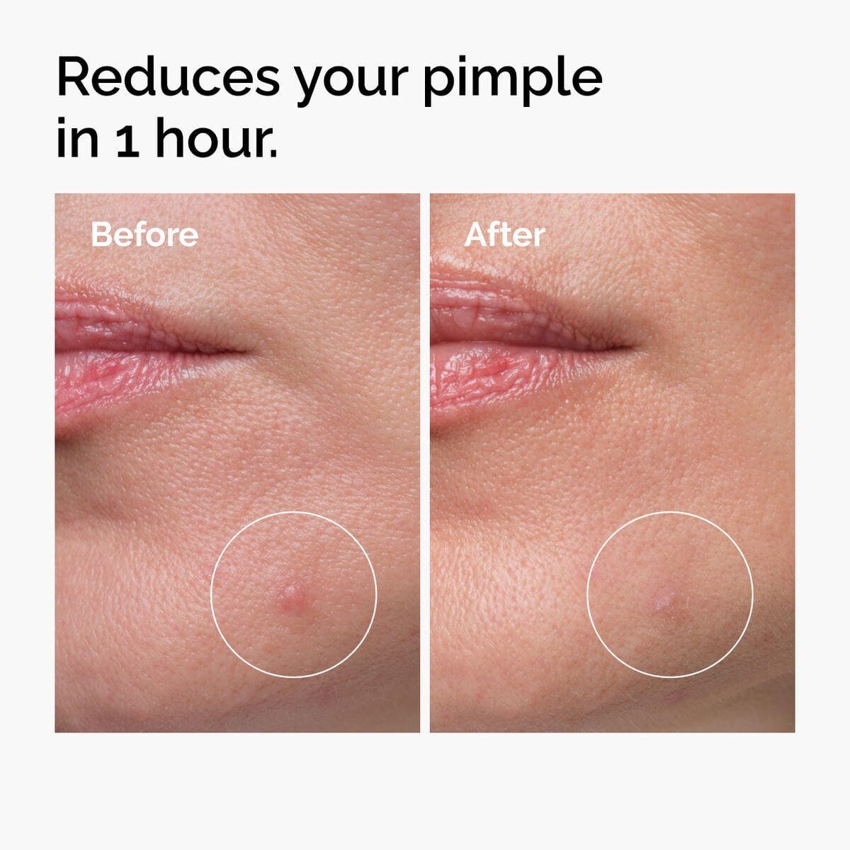 sulfur-10-powder-to-cream-concentrate-j3 ord-sulfur-10pct-powder-to-cream-concentrate-before-after-NA.jpg